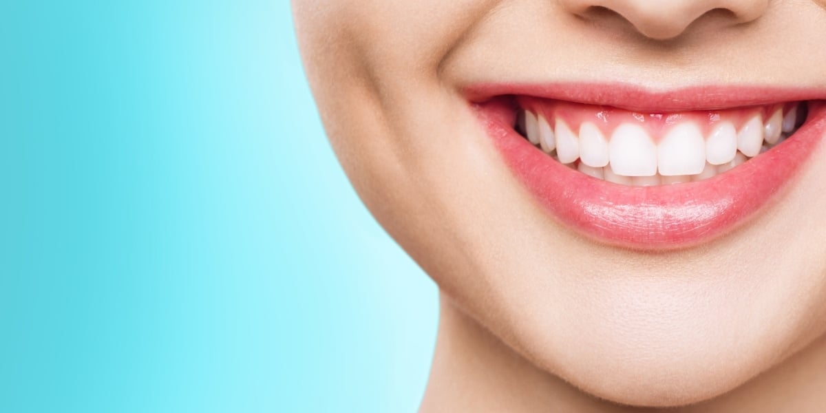 Sonrisa radiante: descubrí todo sobre el blanqueamiento dental