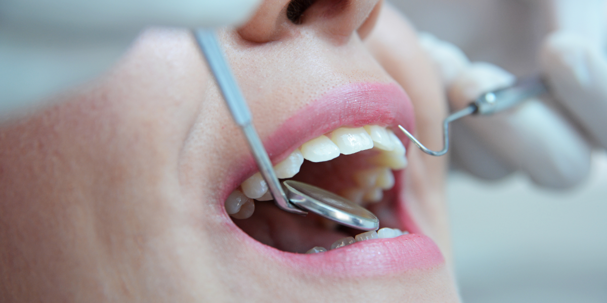 Diabetes y enfermedad periodontal: una relación de doble vía